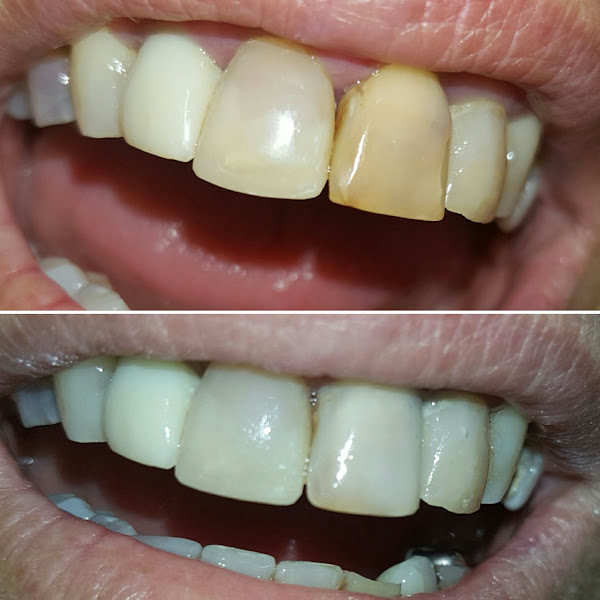 Foto 3 de Consultório Odontológico Dra Natália Pereira