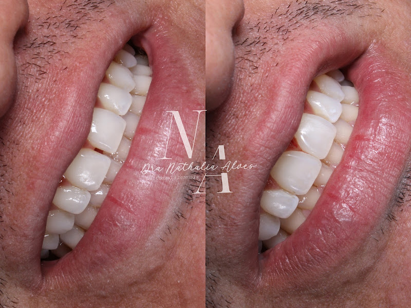 Foto 3 de Consultório Odontológico Dra. Nathalia Alves