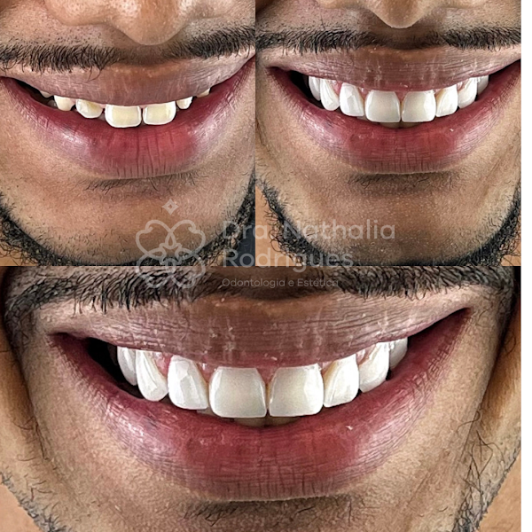 Foto 2 de Consultório Odontológico Dra. Nathalia Rodrigues