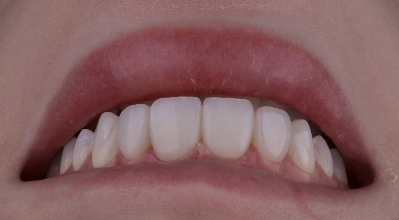 Foto 3 de Consultório odontológico Dra Nathalya Engelmann | Dentista