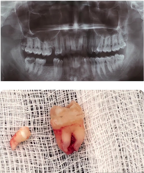 Foto 3 de Consultório Odontológico Dra. Paula Poloni