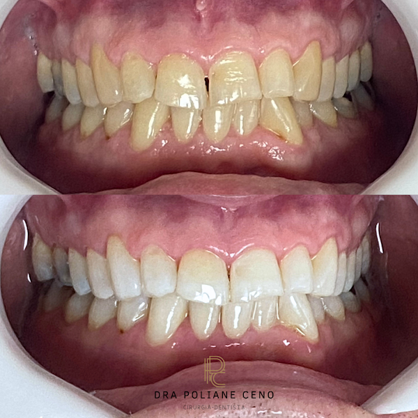 Foto 2 de Consultório odontológico Dra Poliane Ceno - Aparelho Dental Adultos e Crianças