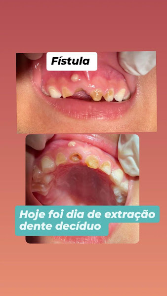 Foto 3 de Consultório Odontológico Dra Rayani Borges