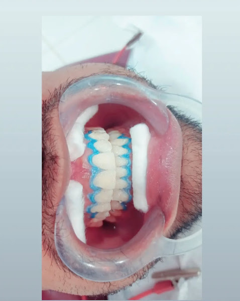 Foto 3 de Consultório Odontológico Dra. Sâmia Lima