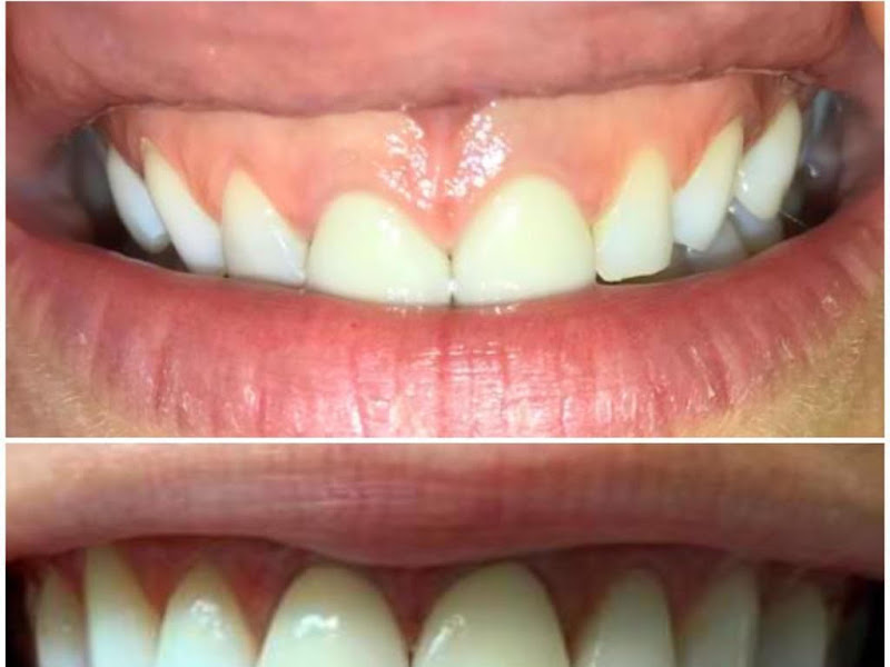 Foto de Consultório Odontológico Dra. Sandra Maria Barboza Bijvoet