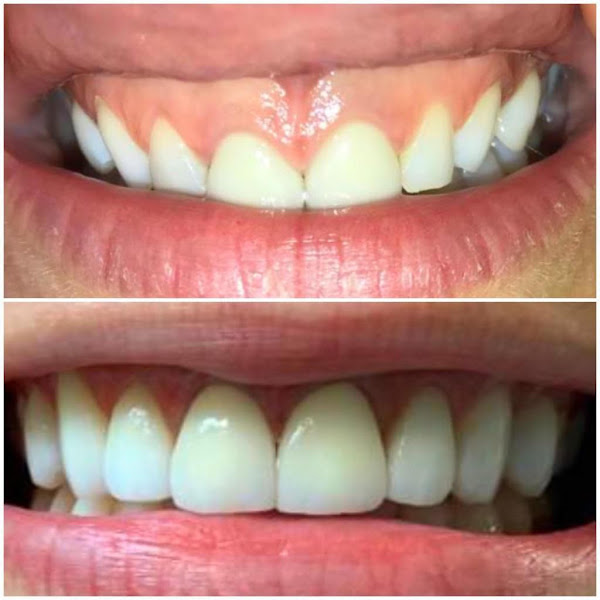 Foto 2 de Consultório Odontológico Dra. Sandra Maria Barboza Bijvoet