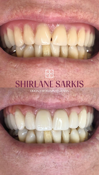 Foto 2 de Consultorio Odontologico Dra Shirlane Sarkis