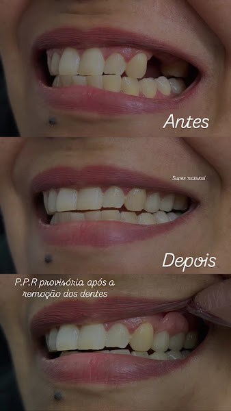 Foto 3 de Consultório Odontológico Dra. Tayná Carrascosa