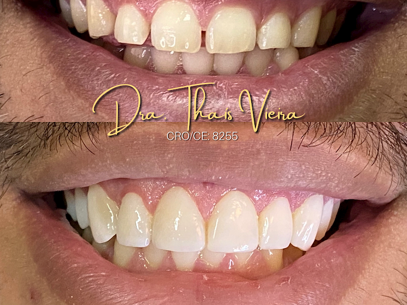 Foto 3 de Consultório Odontológico Dra. Thais goncalves De Melo