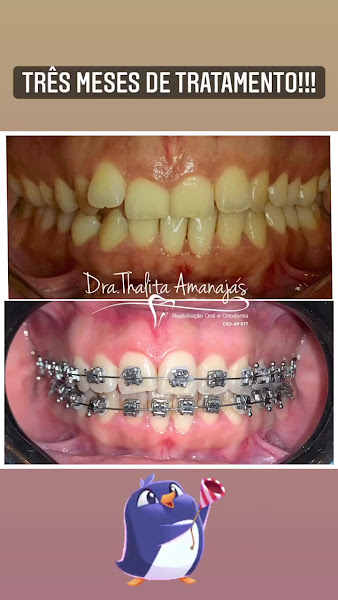 Foto 3 de Consultório Odontológico Dra. Thalita Amanajás