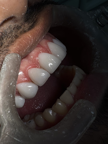 Foto 2 de Consultório Odontológico Dra.Thielly Ribeiro e Dra.Gisele Ribeiro