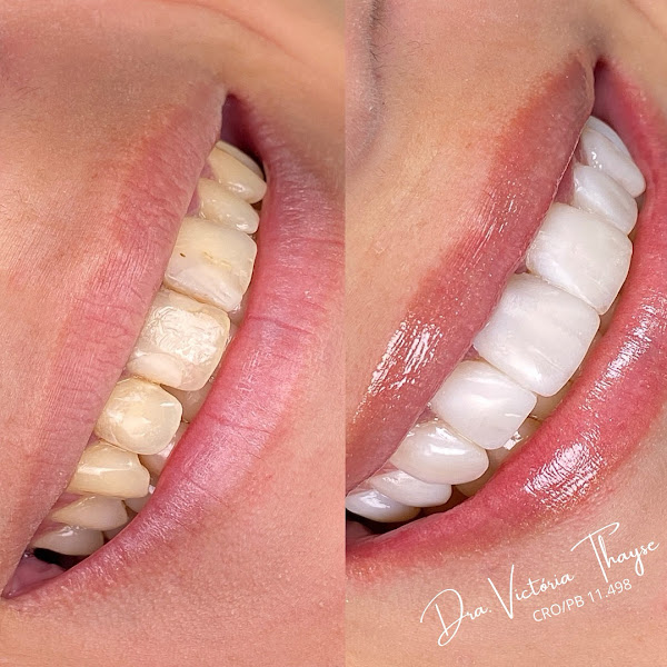 Foto 3 de Consultório Odontológico Dra. Victoria Thayse