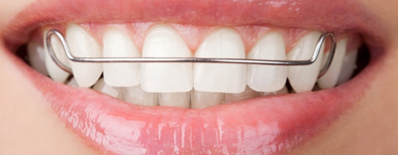 Foto 2 de Consultorio odontológico Edileusa Vieira
