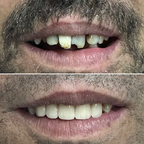 Foto 3 de Consultório Odontológico Estética e Saúde - Implantes, Botox, Canal, Harmonização, Dentista bairro Pedra Azul