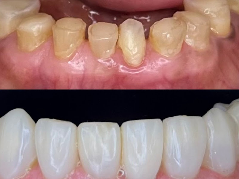 Foto 2 de Consultório Odontológico Giovanna Lima | Estética & Reabilitação Oral