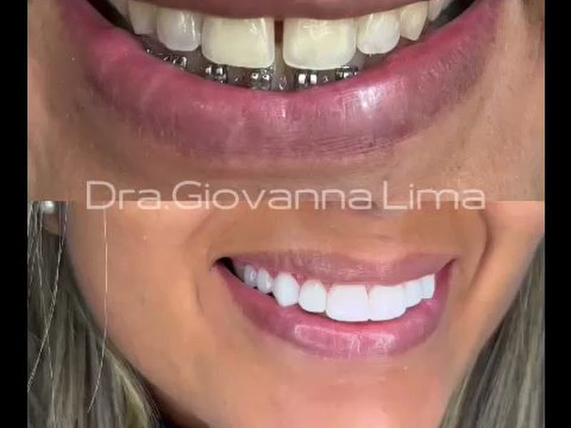 Foto 3 de Consultório Odontológico Giovanna Lima | Estética & Reabilitação Oral