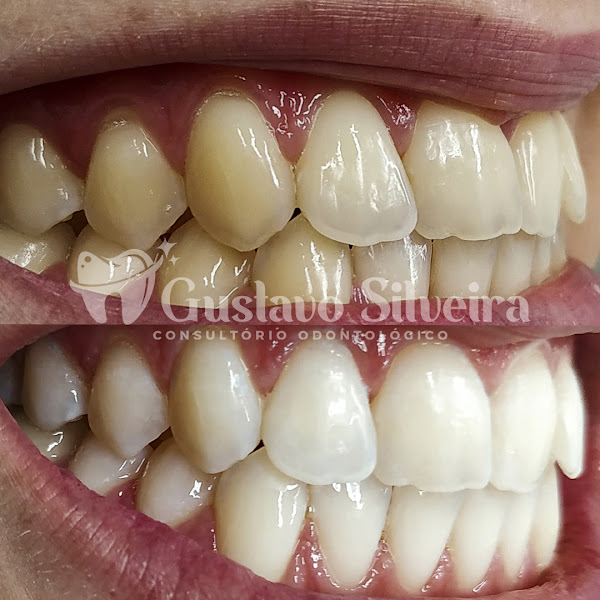 Foto 3 de Consultório Odontológico Gustavo Silveira