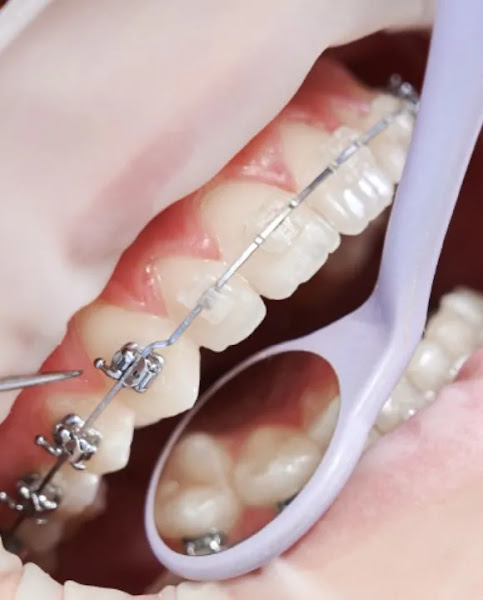 Foto 3 de Consultório Odontológico Indaiatuba WOOD ODONTO - Dentistas, Ortodontia, Periodontia, Implante, Prótese e Clareamento