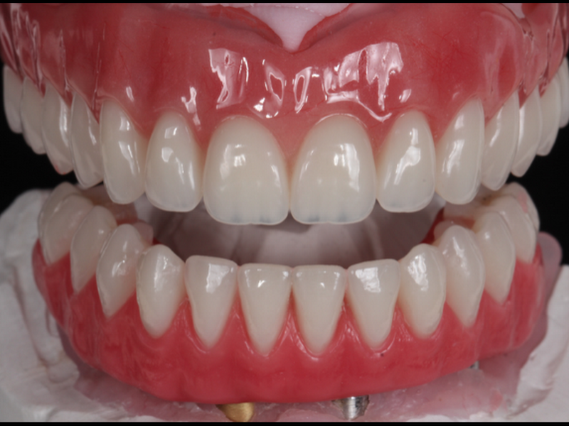 Foto 3 de Consultório odontológico Ivânio Tagliari