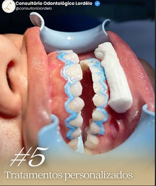 Foto 3 de Consultório odontológico Lordêlo