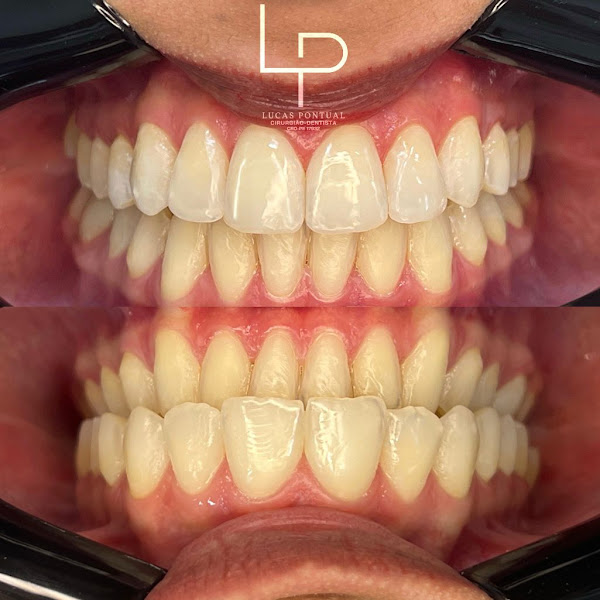 Foto 2 de Consultório odontológico Lucas Pontual | Implantes dentários, Próteses, Facetas