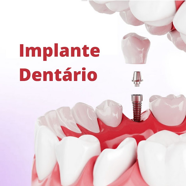 Foto 3 de Consultório Odontológico Mayra Buzatto