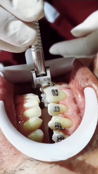Foto 3 de Consultório Odontológico Novo Sorriso