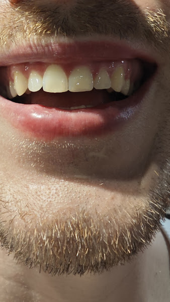 Foto 3 de Consultório Odontológico Particular Bianca Barata | Dentista Emergência 24h WhatsApp | Prótese, Implante - Copacabana/RJ