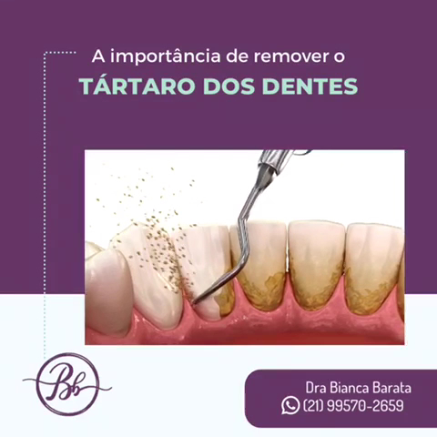 Foto 4 de Consultório Odontológico Particular Bianca Barata | Dentista Emergência 24h WhatsApp | Prótese, Implante - Copacabana/RJ