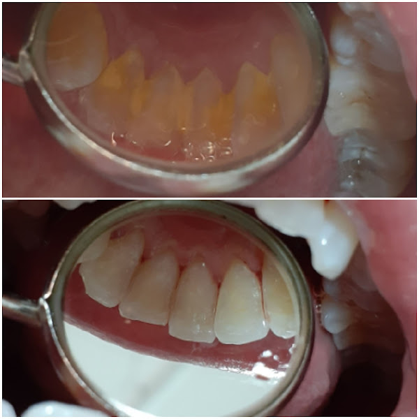 Foto 3 de Consultório Odontológico Patricia Oliveira