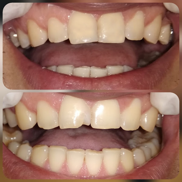 Foto 2 de Consultório Odontológico ProSorrir - Dentista