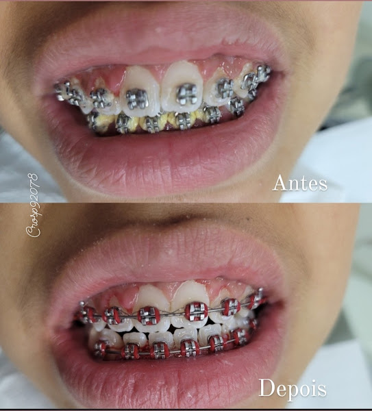 Foto 3 de Consultório Odontológico Rt: L.M.Novaes crosp 92078