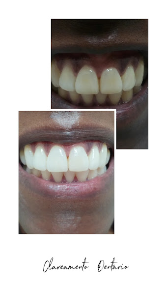 Foto 3 de Consultório Odontológico Taquara- Love Smile