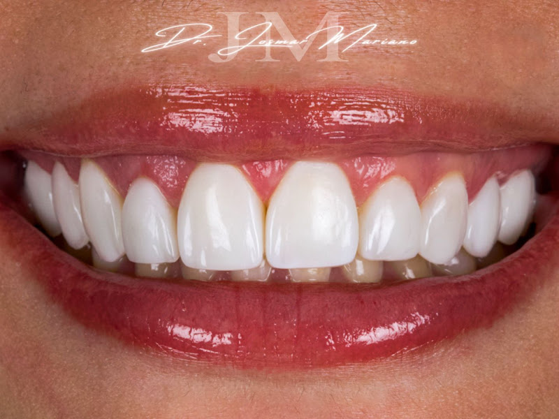 Foto 7 de Consultório Odontológico WM | Ortodontia | Implantes | Tratamento de Canal | Zona Norte Sorocaba