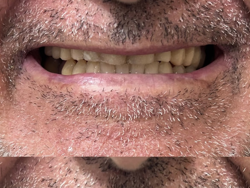 Foto 8 de Consultório Odontológico WM | Ortodontia | Implantes | Tratamento de Canal | Zona Norte Sorocaba