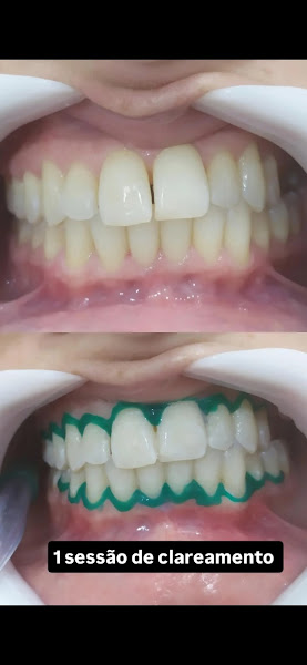 Foto 3 de Consultório Rafaini Odontologia / Prótese dentaria / Endodontia (canal) / Implante dentário / Ortodontia (Aparelho)...