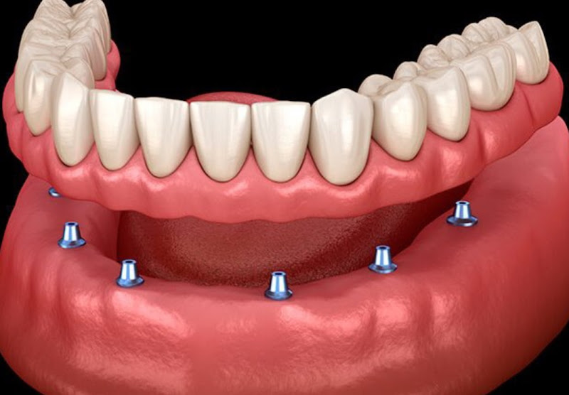 Foto 4 de Consultorio Vila Olimpia(Dr. Dennis Kannebley)