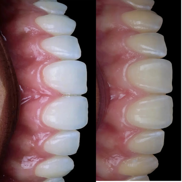 Foto 2 de COP- Clínica Odontológica de Palmas - Dentista em Palmas - Cliníca de Dentista em Palmas - Odonto em Palmas - Dentista-