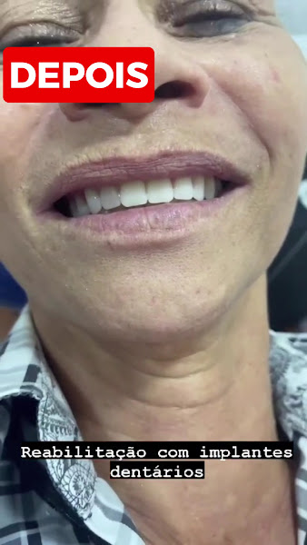 Foto 3 de Cop Dent Prime