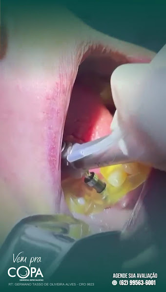 Foto 4 de Copa Dentistas Especialistas - Centro de Aparecida de Goiânia