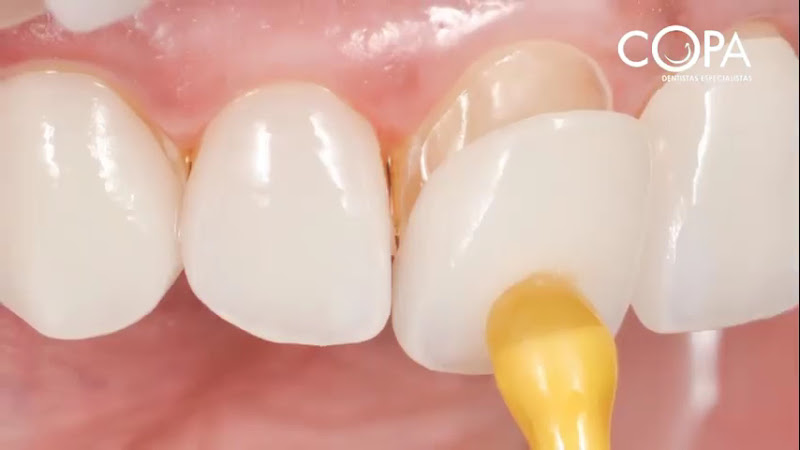 Foto 5 de Copa Dentistas Especialistas - Centro de Aparecida de Goiânia