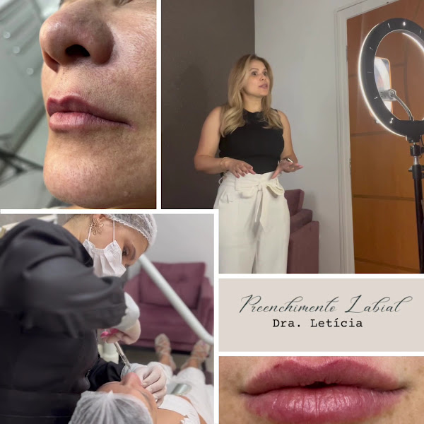 Foto 4 de COPAN | Centro Odontológico Parque das Nações INVISALIGN |IMPLANTES | PROTOCOLO | FACETAS | HARMONIZAÇÃO FACIAL|