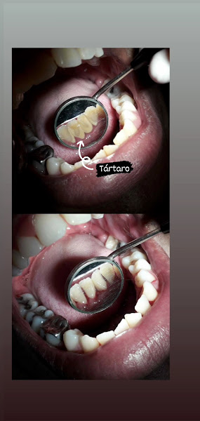 Foto 2 de COPE| Clínica Odontológica de Periperi