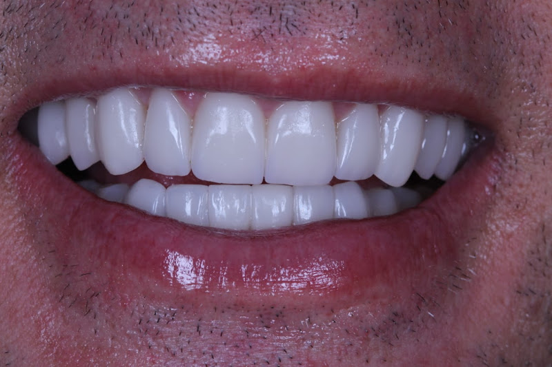 Foto 3 de CORE - Clínica Odontológica de Reabilitação e Estética