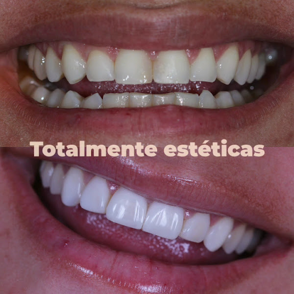 Foto 4 de CORE - Clínica Odontológica de Reabilitação e Estética
