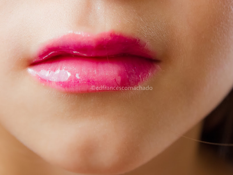 Foto 9 de Coredent Centro Odontológico | Implantes dentários em Campo Grande | dentista em Campo Grande