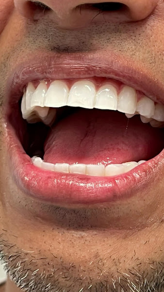 Foto 3 de Costa Lima Odontologia | Dentista especialista em implante dentário em Madureira