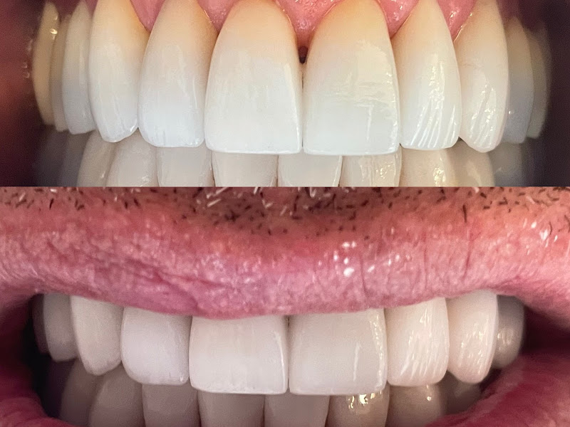 Foto 6 de CR Montenegro Odontologia | Ortodontia | Invisalign Doctor Recife | DTM | Sono | Lentes de contato | Estética