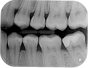 Foto 3 de Crânio X Clínica de Imagens Odontológicas