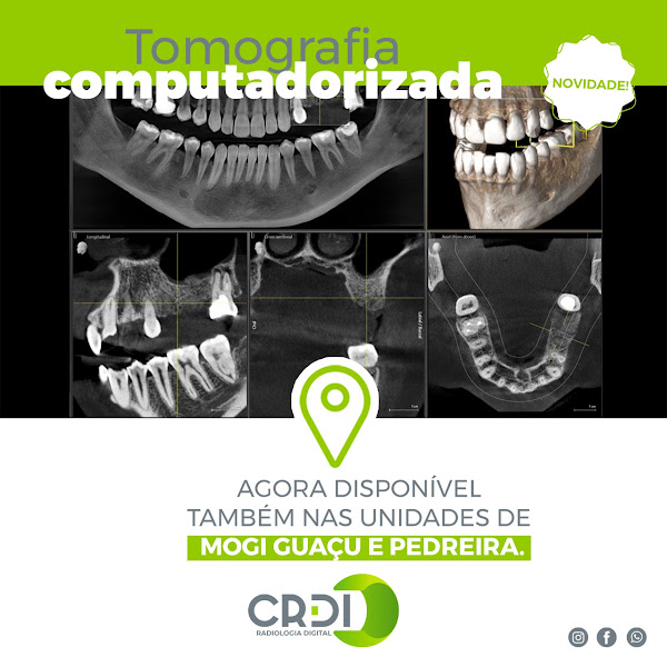 Foto 2 de CRDI - Centro de Radiologia e Diagnóstico por Imagem